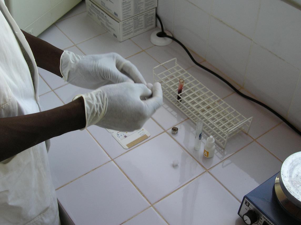labo sneltest malaria